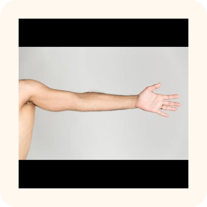arm