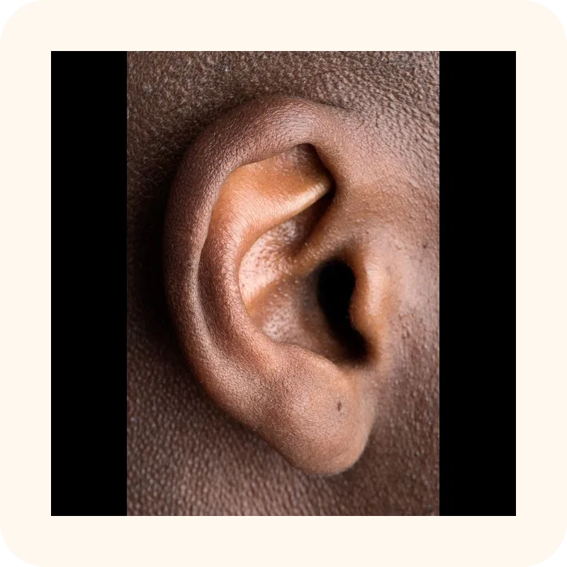 ear