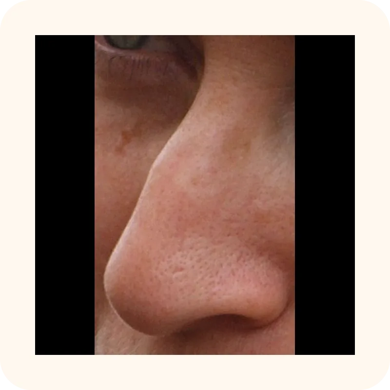 nose