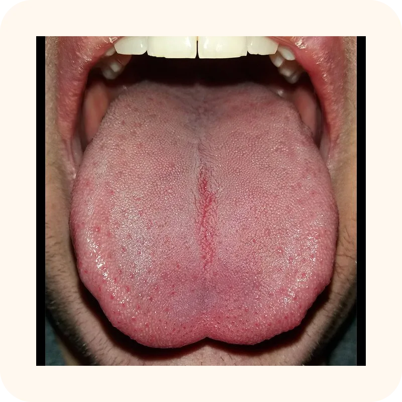 tongue